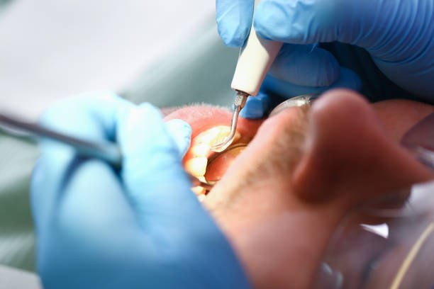 Best Weekend Emergency Dentist in Montrose, PA