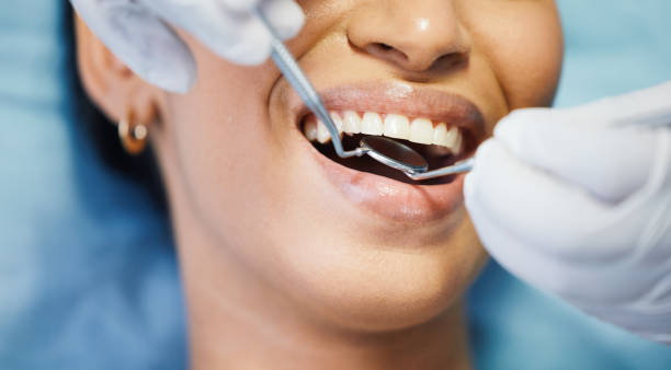 Best Emergency Tooth Extraction in Montrose, PA
